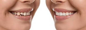 cosmetic-dentistry